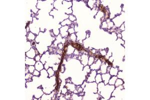 IHC testing of FFPE human lung tissue with C-Reactive Protein antibody at 2ug/ml. (CRP antibody  (AA 20-230))