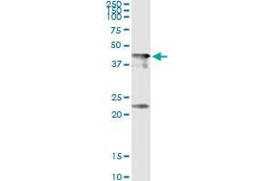 Immunoprecipitation of CENPJ transfected lysate using anti-CENPJ monoclonal antibody and Protein A Magnetic Bead , and immunoblotted with CENPJ MaxPab rabbit polyclonal antibody.