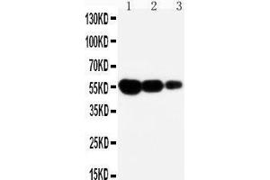 Anti-CD95 antibody, Western blotting Lane 1: Recombinant Mouse FAS Protein 10ng Lane 2: Recombinant Mouse FAS Protein 5ng Lane 3: Recombinant Mouse FAS Protein 2. (FAS antibody  (N-Term))