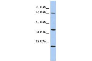 WB Suggested Anti-FAM79B Antibody Titration: 0. (TPRG1 antibody  (N-Term))