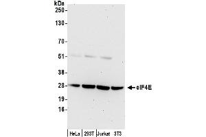 Western Blotting (WB) image for anti-Eukaryotic Translation Initiation Factor 4E (EIF4E) (AA 167-217) antibody (ABIN7450203)