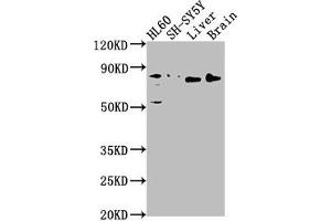 Western Blot Positive WB detected in: HL60 whole cell lysate, SH-SY5Y whole cell lysate, Rat liver tissue, Rat brain tissue All lanes: DNAJC10 antibody at 1:1000 Secondary Goat polyclonal to rabbit IgG at 1/50000 dilution Predicted band size: 92, 87, 38 kDa Observed band size: 80 kDa (DNAJC1 antibody  (AA 521-793))