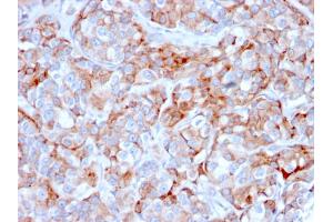 Immunohistochemistry (IHC) image for anti-Tumor Necrosis Factor Receptor Superfamily, Member 17 (TNFRSF17) (AA 78-184) antibody (ABIN6940533)