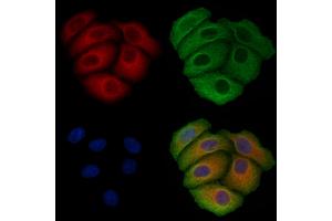 ABIN6257497 and ABIN6275601 staining Hela cells by IF/ICC. (Sorting Nexin 3 antibody  (Internal Region))