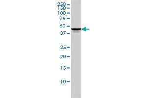 TSSK2 monoclonal antibody (M01), clone 1E12 Western Blot analysis of TSSK2 expression in HL-60 . (TSSK2 antibody  (AA 1-358))