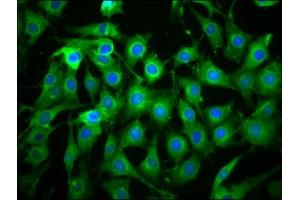 Immunofluorescence staining of NIH/3T3 cells with ABIN7166183 at 1:133, counter-stained with DAPI. (C1orf38 antibody  (AA 62-177))
