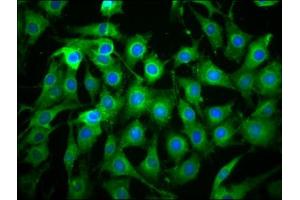 Immunofluorescence staining of NIH/3T3 cells with ABIN7166183 at 1:133, counter-stained with DAPI.