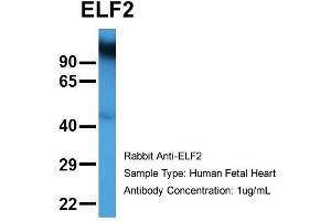 Host:  Rabbit  Target Name:  ELF2  Sample Type:  Human Fetal Heart  Antibody Dilution:  1.