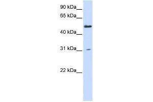 AGXT2L2 antibody used at 0. (AGXT2L2 antibody  (N-Term))