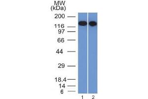 Western blot testing of FFPE human 1) Raji and 2) Ramos cell lysate with CD22 antibody (clone BLCAM/1795).