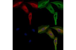 ABIN6264545 and ABIN6272404 staining  cells by IF/ICC. (SIK3 antibody  (Internal Region))