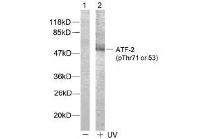 Image no. 2 for anti-Activating Transcription Factor 2 (ATF2) (pThr53), (pThr71) antibody (ABIN196666) (ATF2 antibody  (pThr53, pThr71))
