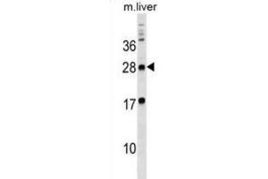 Western Blotting (WB) image for anti-Myelin Protein Zero-Like 3 (MPZL3) antibody (ABIN3000006) (MPZL3 antibody)