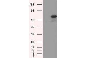 HEK293T cells were transfected with the pCMV6-ENTRY control (Left lane) or pCMV6-ENTRY ARNTL (Right lane) cDNA for 48 hrs and lysed. (ARNTL antibody)