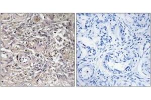 Immunohistochemistry analysis of paraffin-embedded human ovary tissue, using CLDN6 Antibody.