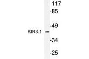 Western blot analysis of KIR3. (KCNJ3 antibody)