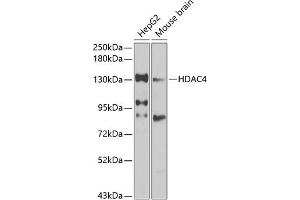 Western blot analysis of extracts of various cell lines, using HD antibody (ABIN6128012, ABIN6141669, ABIN6141672 and ABIN6213648) at 1:1000 dilution. (HDAC4 antibody  (AA 451-650))