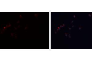 ABIN6277808 staining A-431 cells by ICC/IF. (PLIN1 antibody  (C-Term))
