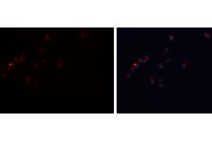 ABIN6277808 staining A-431 cells by ICC/IF. (PLIN1 antibody  (C-Term))