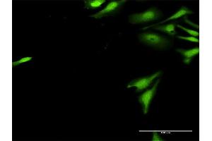 Immunofluorescence of purified MaxPab antibody to UBE2G2 on HeLa cell. (UBE2G2 antibody  (AA 1-137))