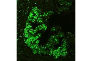 IF analysis of APEX1 using anti-APEX1 antibody (ABIN3043785). (APEX1 antibody  (AA 2-318))