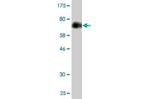 Western Blot detection against Immunogen (65. (ZFC3H1 antibody  (AA 1-358))