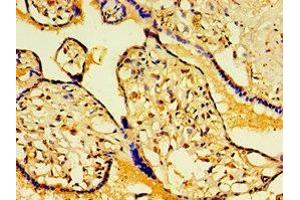 Immunohistochemistry of paraffin-embedded human placenta tissue using ABIN7154837 at dilution of 1:100 (FAM29A antibody  (AA 676-955))