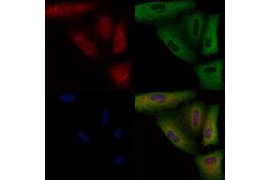ABIN6258296 and ABIN6274603 staining  cells by IF/ICC. (P-Cadherin antibody  (N-Term))