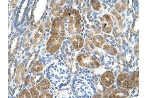 C6ORF21 antibody was used for immunohistochemistry at a concentration of 4-8 ug/ml to stain Epithelial cells of renal tubule (arrows) in Human Kidney.