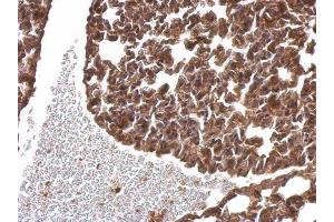 IHC-P Image alpha SNAP antibody [N2C3] detects alpha SNAP protein at cytosol on mouse lung by immunohistochemical analysis.