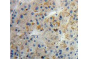IHC-P analysis of Liver tissue, with DAB staining. (LALBA antibody  (AA 12-142))