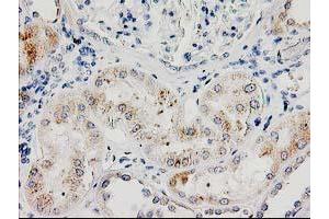 Immunohistochemical staining of paraffin-embedded Human Kidney tissue using anti-ILVBL mouse monoclonal antibody. (ILVBL antibody)