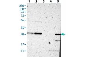 Western blot analysis of Lane 1: RT-4, Lane 2: U-251 MG, Lane 3: Human Plasma, Lane 4: Liver, Lane 5: Tonsil with TSPAN13 polyclonal antibody .
