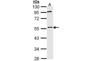 WB Image Sample (30 ug of whole cell lysate) A: Hep G2 , 10% SDS PAGE antibody diluted at 1:1000 (MPP1 antibody  (Center))