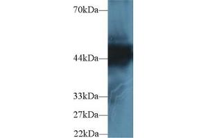 Detection of CK18 in Human Hela cell lysate using Polyclonal Antibody to Cytokeratin 18 (CK18) (Cytokeratin 18 antibody  (AA 238-396))