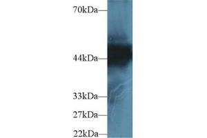Detection of CK18 in Human Hela cell lysate using Polyclonal Antibody to Cytokeratin 18 (CK18) (Cytokeratin 18 antibody  (AA 238-396))