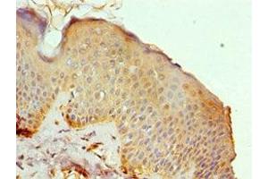 Immunohistochemistry of paraffin-embedded human skin tissue using ABIN7150623 at dilution of 1:100 (Mre11 antibody  (AA 1-205))