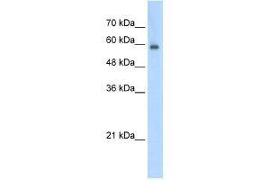 WB Suggested Anti-EIF4G3 Antibody Titration:  0.