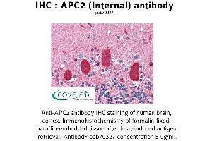 Image no. 1 for anti-APC Regulator of WNT Signaling Pathway 2 (APC2) (Internal Region) antibody (ABIN1731845) (APC2 antibody  (Internal Region))