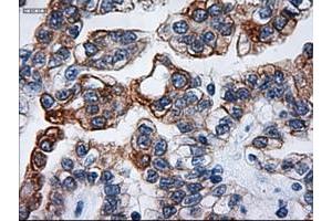 Image no. 1 for anti-Keratin 18 (KRT18) (AA 69-372) antibody (ABIN1491637) (Cytokeratin 18 antibody  (AA 69-372))