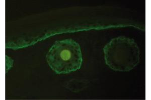 Immunofluorescence image of Collagen type XVII staining in cryosection of murine Skin. (COL17 antibody)