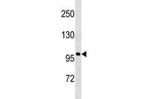 Western Blotting (WB) image for anti-Androgen Receptor (AR) antibody (ABIN3029944)