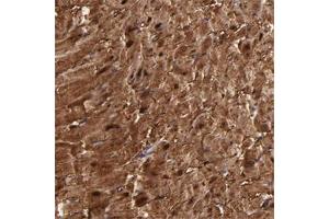Immunohistochemical staining of human heart muscle with MB polyclonal antibody  shows strong cytoplasmic and nuclear positivity in myocytes at 1:200-1:500 dilution. (Myoglobin antibody)