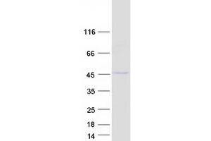 Western Blotting (WB) image for SGT1, Suppressor of G2 Allele of SKP1 (SUGT1) (Transcript Variant 1) protein (Myc-DYKDDDDK Tag) (ABIN2732925)