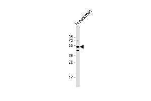 Anti-GIPR Antibody (Center) at 1:1000 dilution + human pancreas lysate Lysates/proteins at 20 μg per lane.