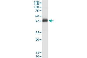 anti-Fc Fragment of IgG, Low Affinity IIb, Receptor (CD32) (FCGR2B) (AA 1-310) antibody