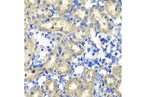 Immunohistochemistry of paraffin-embedded rat kidney using ABAT antibody. (ABAT antibody  (AA 29-300))