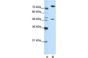 Western Blotting (WB) image for anti-Sjogren Syndrome Antigen B (SSB) antibody (ABIN2462144) (SSB antibody)
