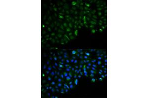 Immunofluorescence analysis of U2OS cells using HK2 antibody. (Hexokinase 2 antibody  (AA 1-120))