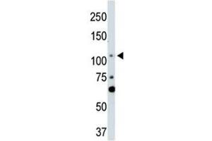 Western Blotting (WB) image for anti-LATS, Large Tumor Suppressor, Homolog 2 (Drosophila) (LATS2) (AA 228-258) antibody (ABIN3031595)
